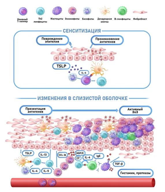 1.2 Этиология и патогенез заболевания или состояния (группы заболеваний или состояний) — Эозинофильный эзофагит