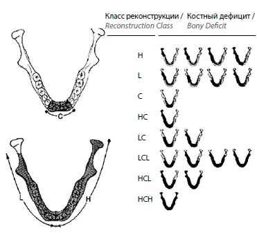 1.5 Классификация заболевания или состояния — Комбинированные врожденные и приобретенные дефекты и деформации челюстно-лицевой локализации