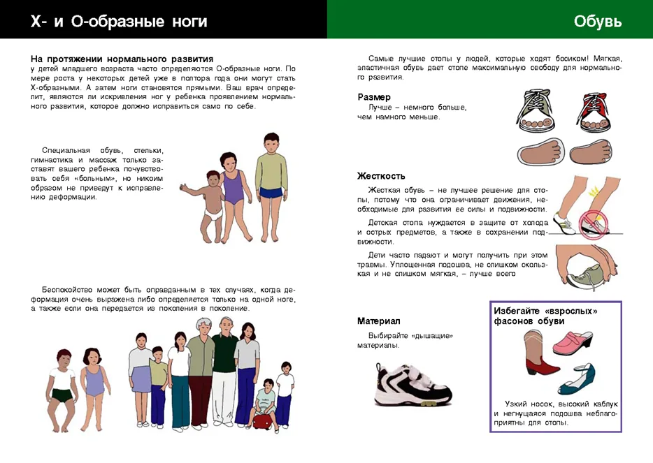 Приложение В. Информация для пациента — Плоскостопие у детей