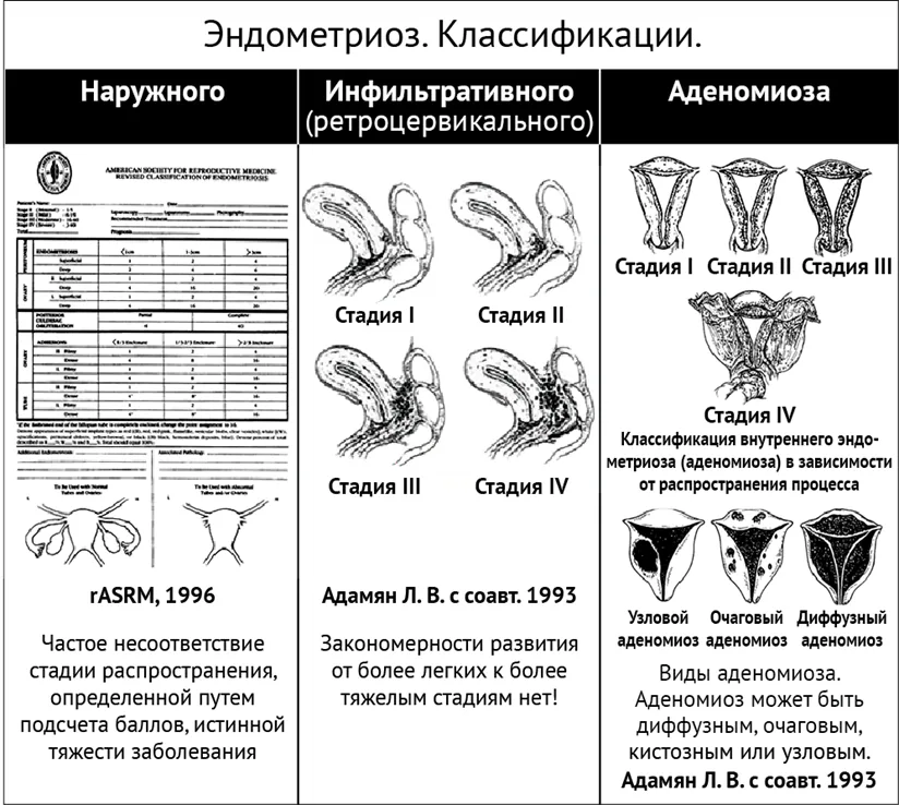 Приложение А3. Справочные материалы — Эндометриоз