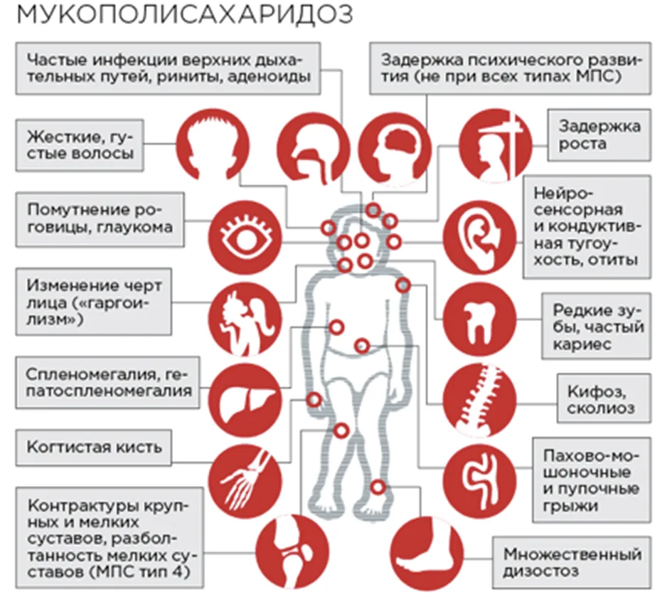 Приложение В. Информация для пациента — Мукополисахаридоз тип I
