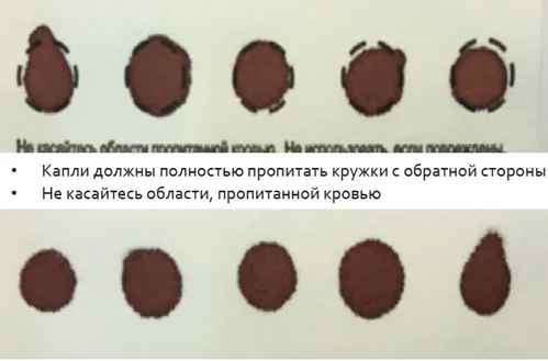 Приложение А3. Справочные материалы — Мукополисахаридоз тип VI