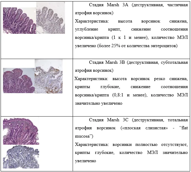 1.5 Классификация заболевания или состояния — Целиакия