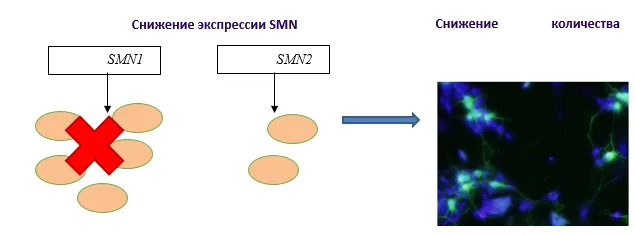 Приложение В. Информация для пациента — Проксимальная спинальная мышечная атрофия 5q