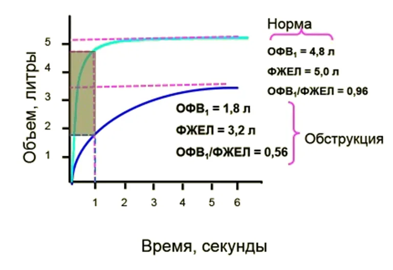 2.4 Инструментальные исследования — Хроническая обструктивная болезнь легких