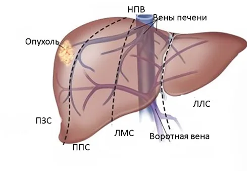 7. Дополнительная информация — Гепатобластома