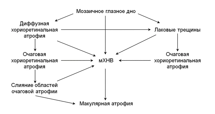 1.6 Клиническая картина заболевания или состояния — Миопическая макулярная дегенерация (Миопическая макулопатия)