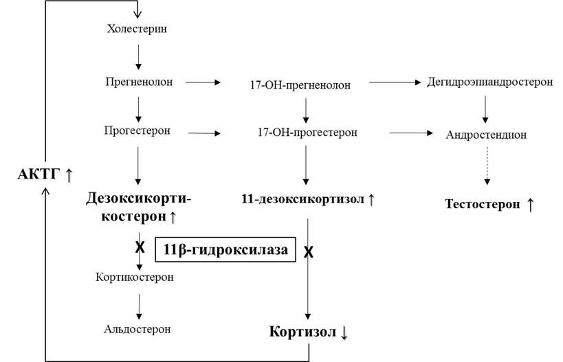 1.2 Этиология и патогенез заболевания или состояния (группы заболеваний или состояний) — Врожденная дисфункция коры надпочечников (адреногенитальный синдром)
