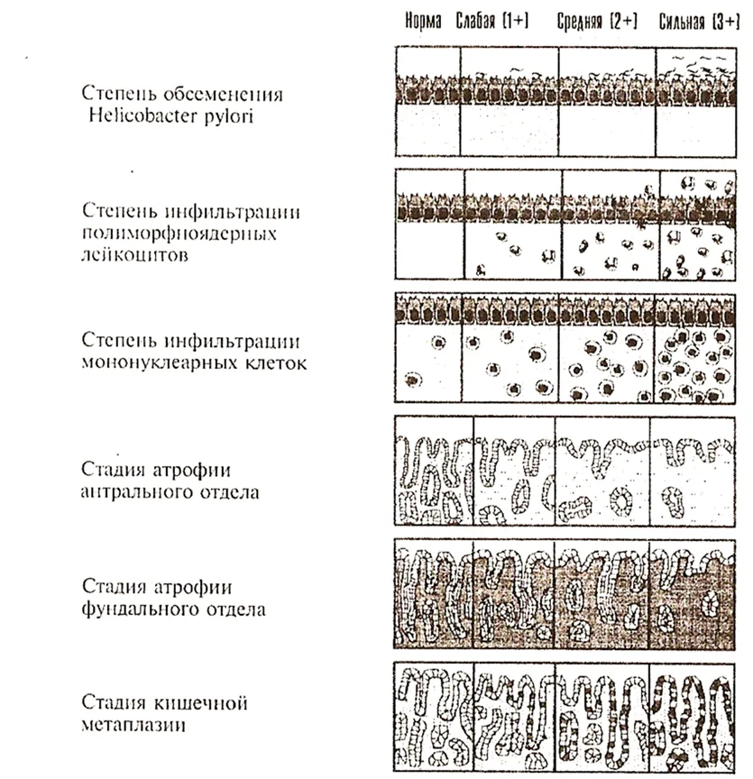 Приложение А3. Справочные материалы — Гастрит и дуоденит у детей