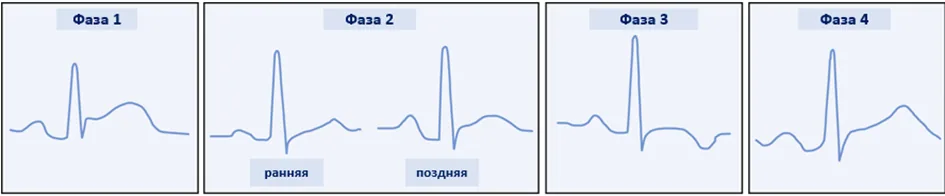 2.4 Инструментальные исследования — Перикардиты и заболевания перикарда у детей