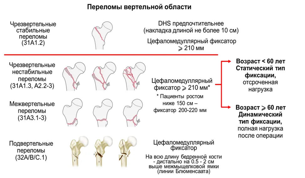 Приложение Б. Алгоритмы действий врача — Переломы проксимального отдела бедренной кости