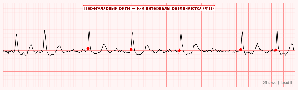 ФП
